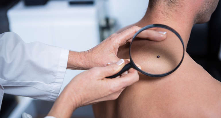 What Does a Skin Cancer Screening Consist Of?