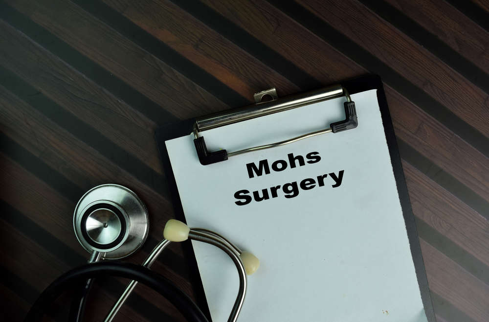 Mohs Surgery FAQ s