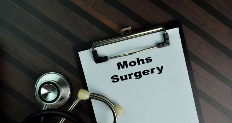 Mohs Surgery FAQ s