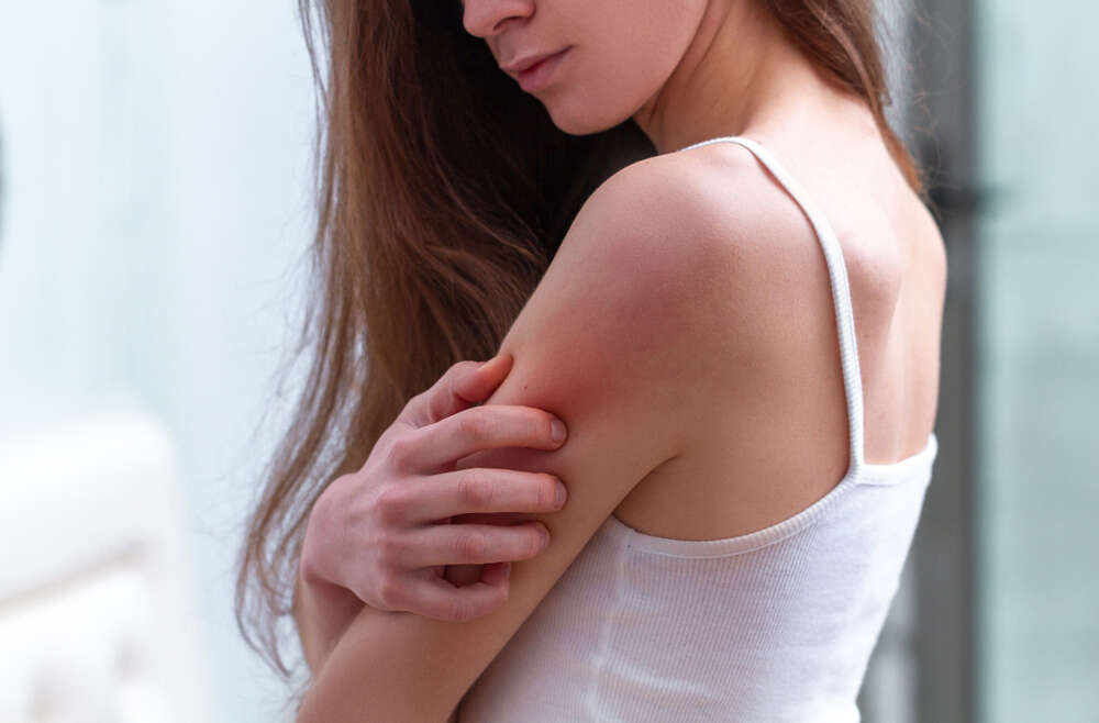 How Can I Cure My Psoriasis for Clear Skin?