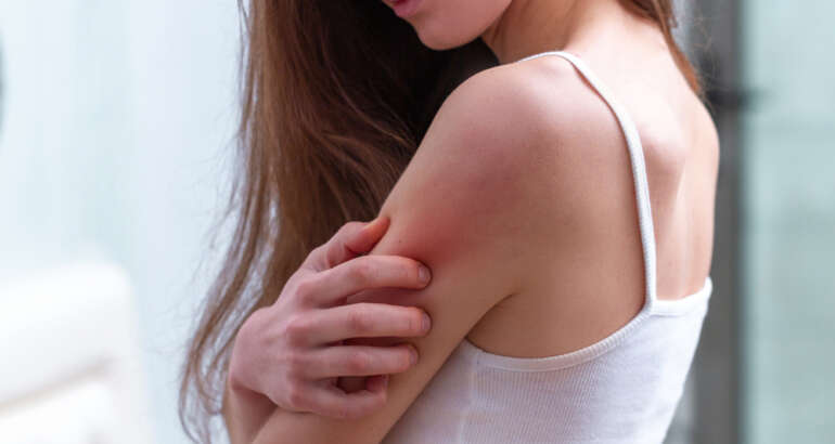 How Can I Cure My Psoriasis for Clear Skin?