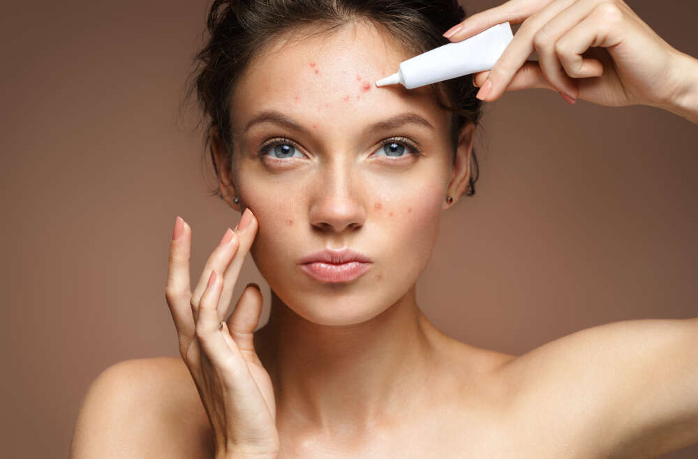 Does My Insurance Cover Acne Visits Acworth Dermatology