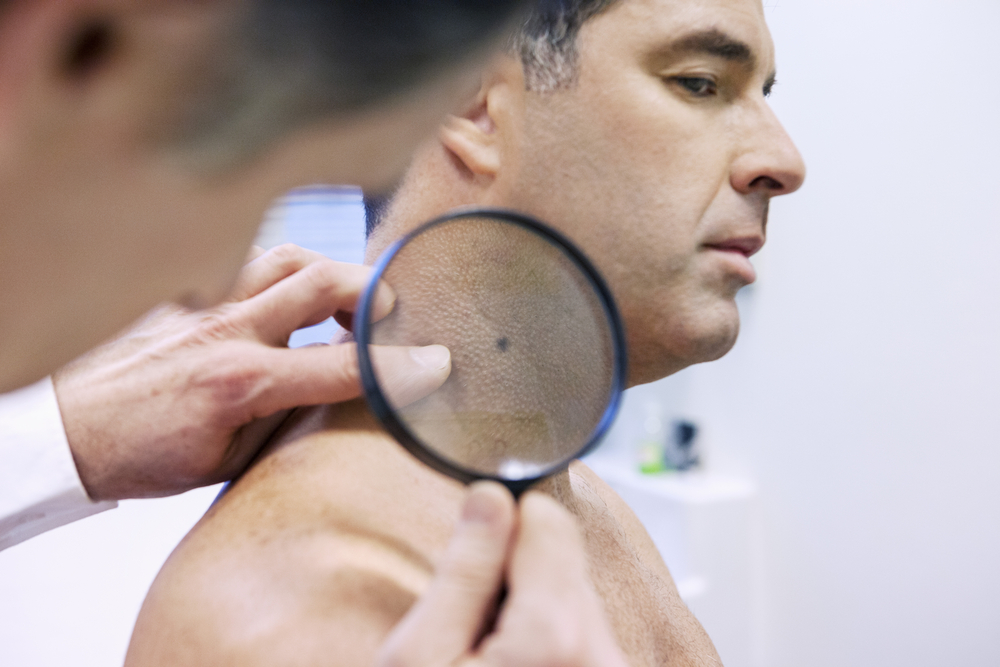 Skin Cancer Screenings