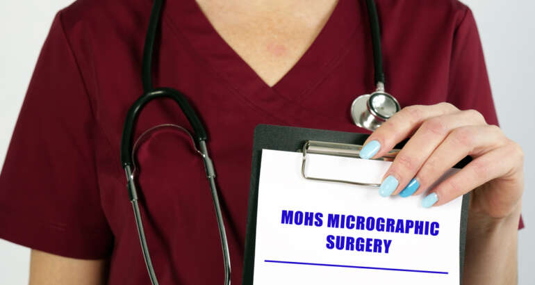 What to Expect From Mohs Surgery: Your Quick Guide to Skin Cancer Treatment