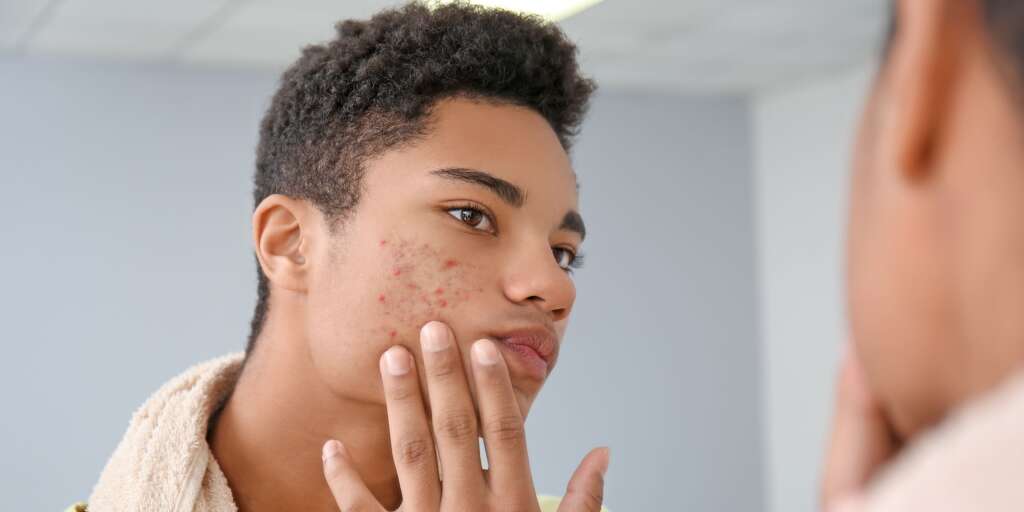 best acne doctor