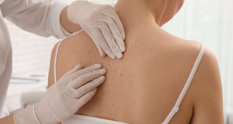 Top Tips for Choosing a Dermatologist Near Indian Village, GA