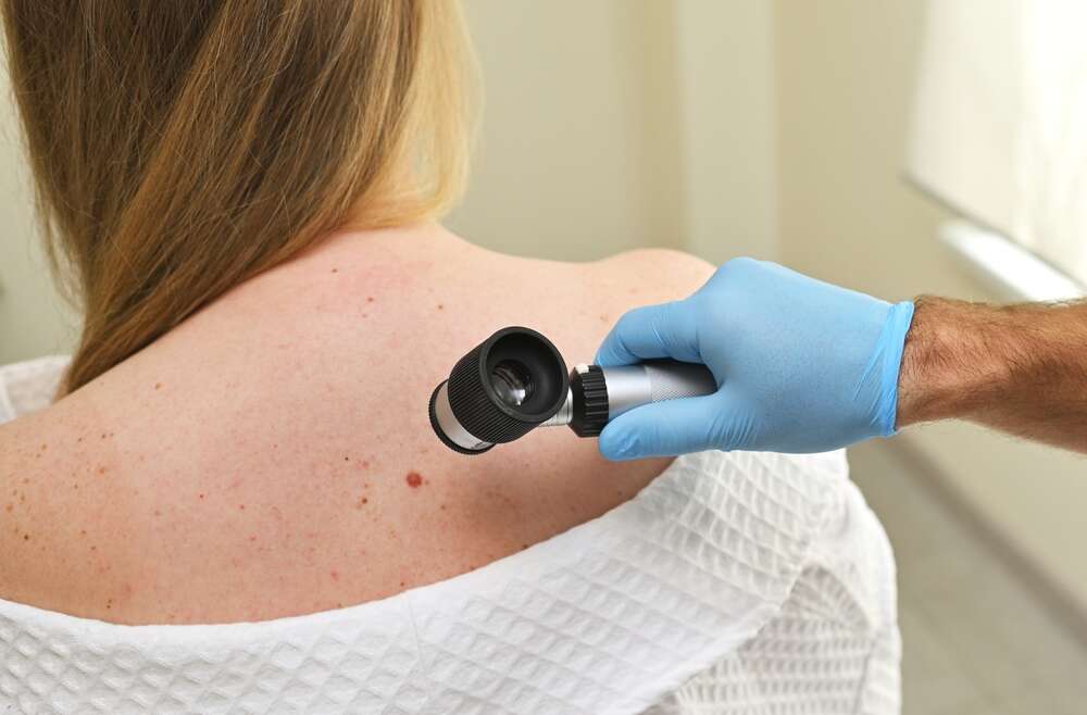 Find the Top Skin Cancer Doctor in Marietta, GA for Mohs Surgery With These 4 Simple Tips