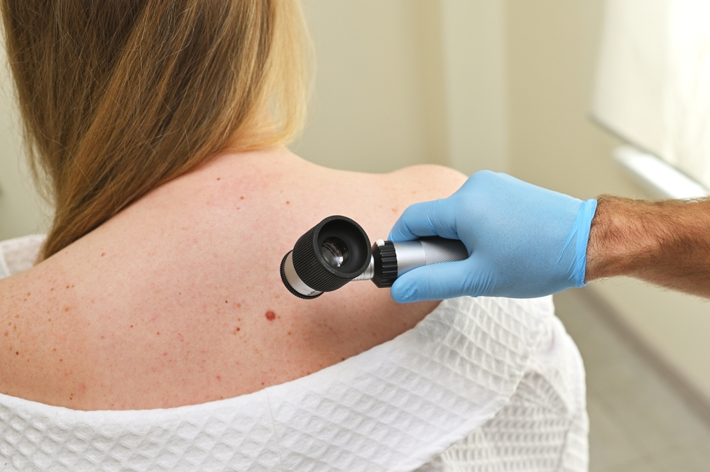 Top Skin Cancer Doctor in Marietta GA