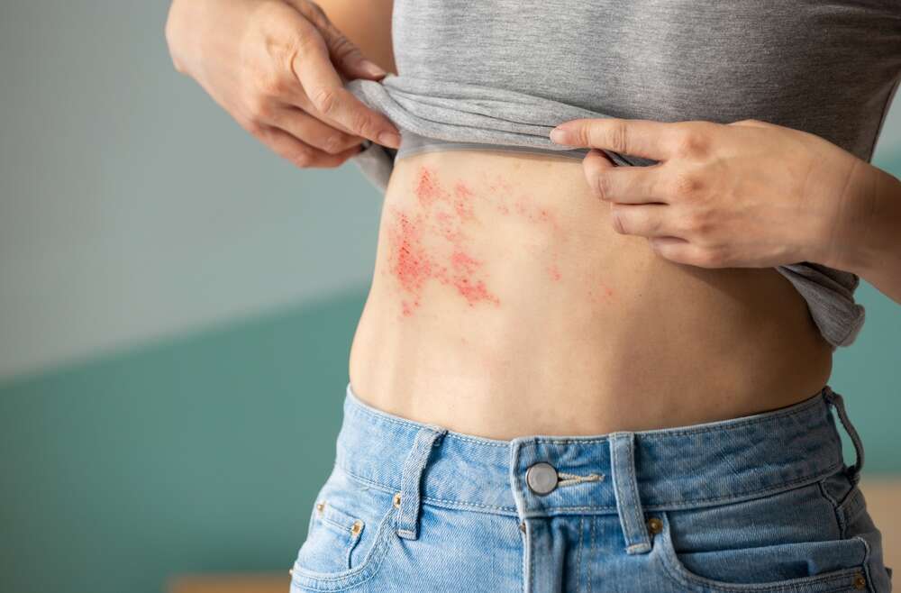 Q & A With a Same-Day Emergency Rash Specialist in Marietta, Georgia