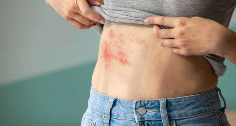 Q & A With a Same-Day Emergency Rash Specialist in Marietta, Georgia