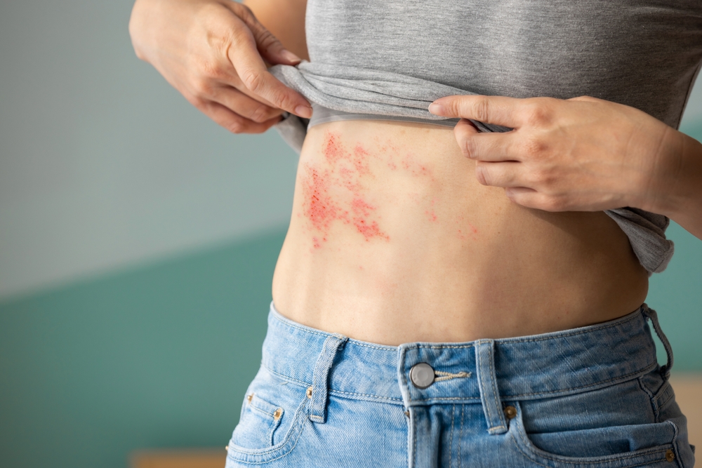 Q & A With a Same-Day Emergency Rash Specialist in Marietta