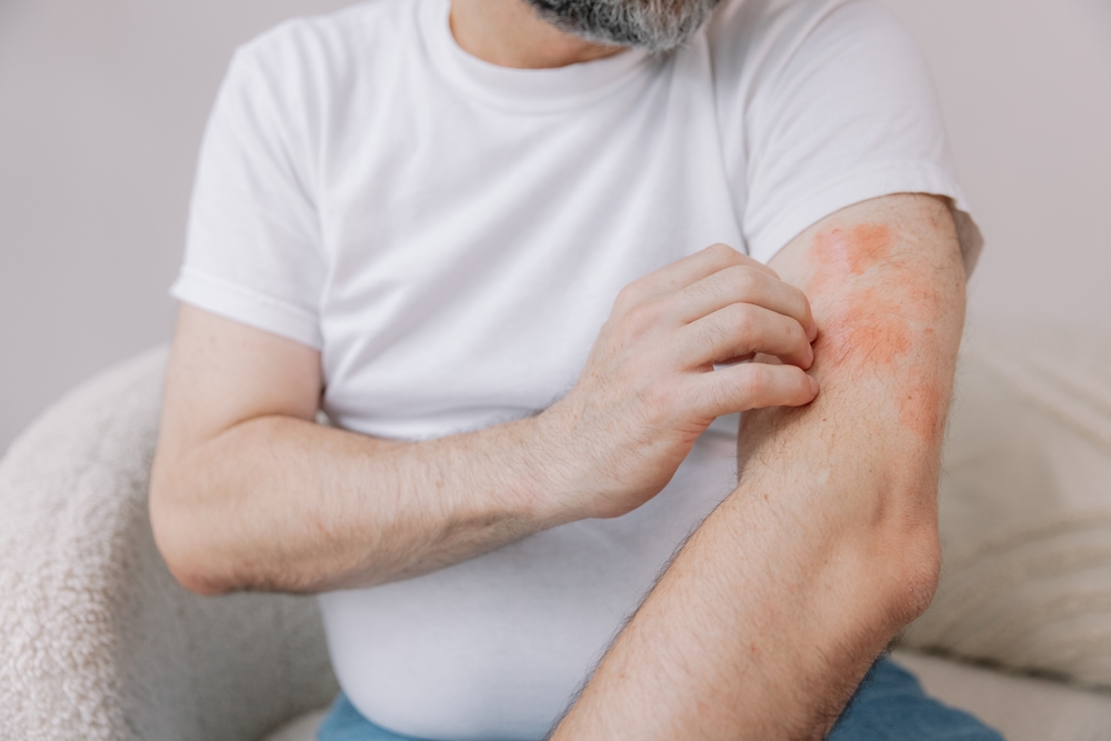 Emergency Rash Doctor in Marietta