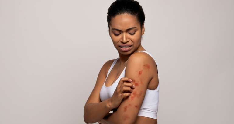 Quick Solutions for Rash Emergencies: Same-Day Dermatology Appointments Near Atlanta