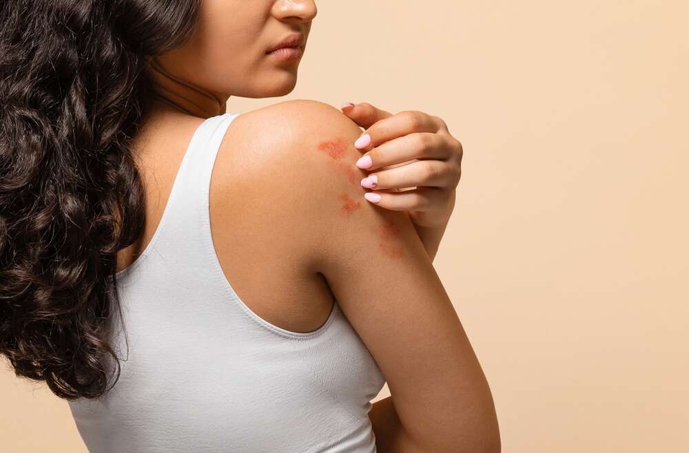 Emergency Dermatology for Rash Treatment in Marietta, GA: Same-Day Appointments Available 