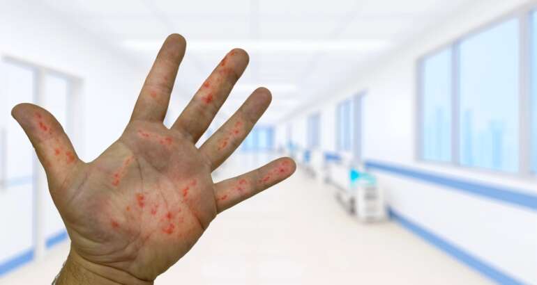 Do You Need an Emergency Rash Appointment Near Marietta?