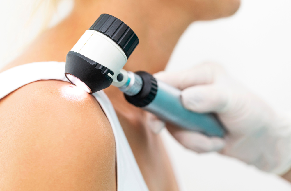 How to Schedule a Skin Cancer Screening Appointment in Marietta, Georgia for Early Detection