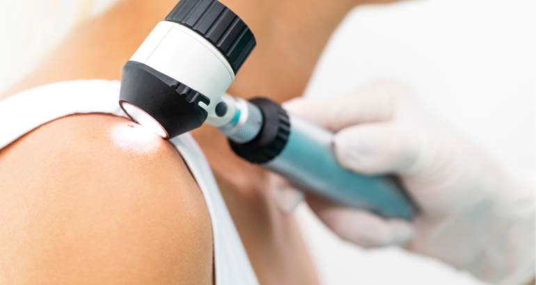 How to Schedule a Skin Cancer Screening Appointment in Marietta, Georgia for Early Detection