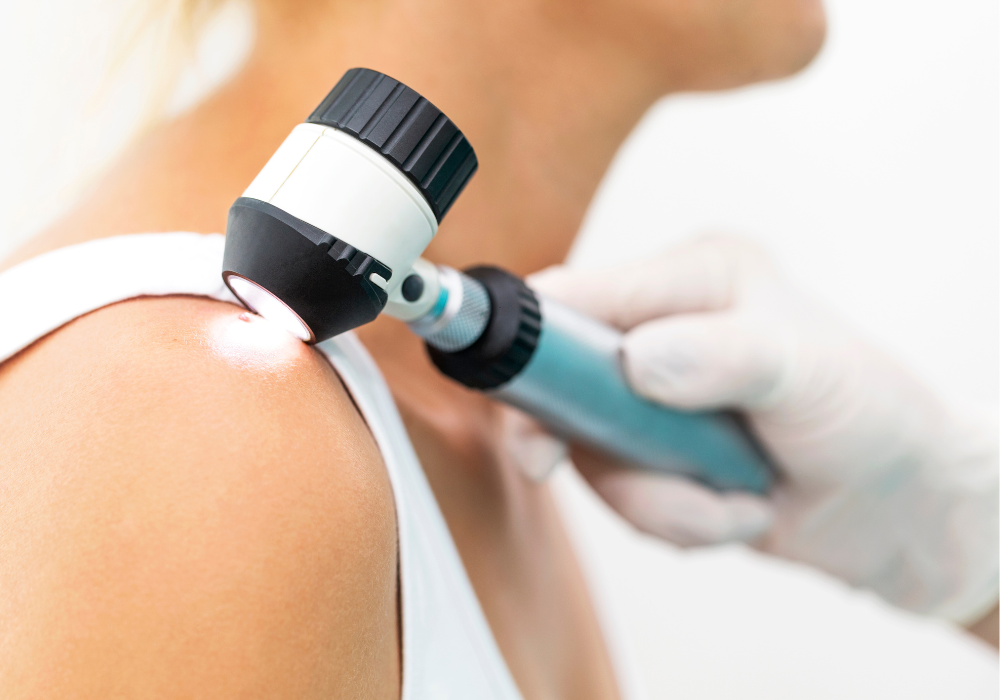 skin cancer screening appointment Marietta