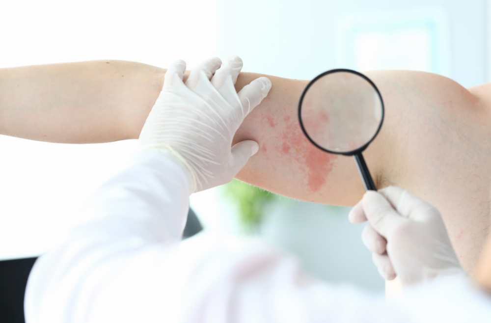 How to Find a Same-Day Dermatology Clinic Near Roswell, Georgia