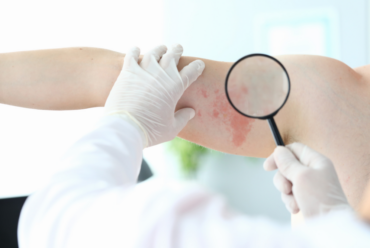 How to Find a Same-Day Dermatology Clinic Near Roswell, Georgia