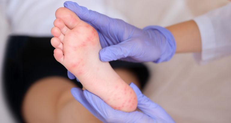Urgent Dermatology Appointment Near Smyrna, Georgia