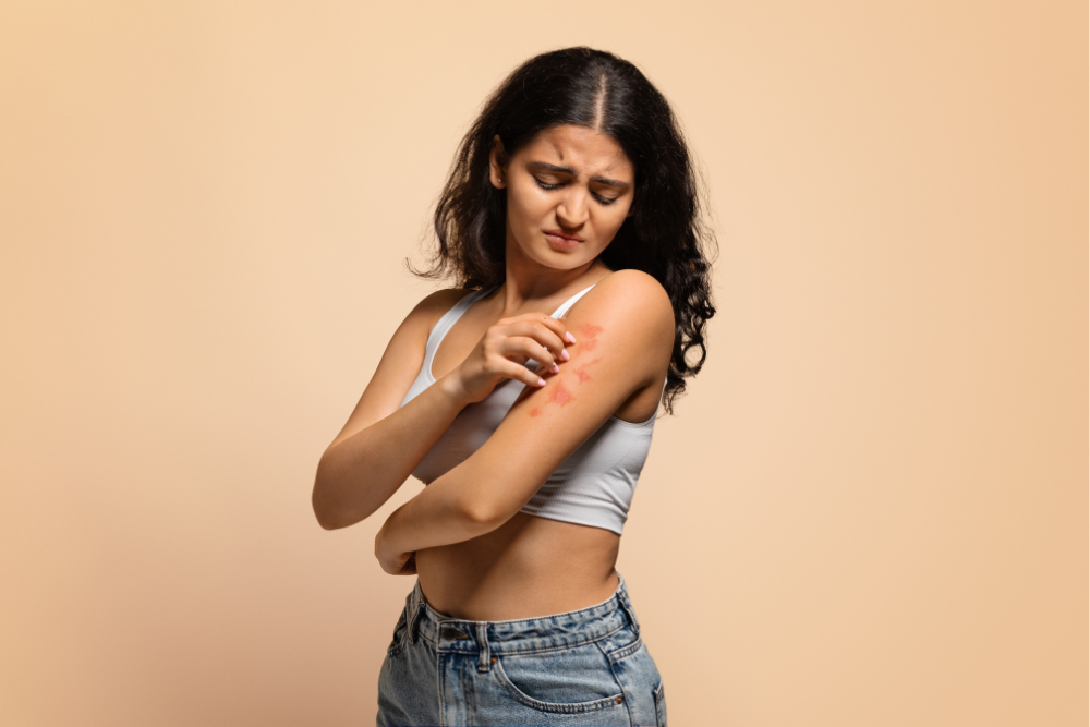 psoriasis Acworth GA