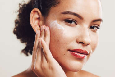 Acne in Kennesaw, GA: Diagnosis and Treatment Options