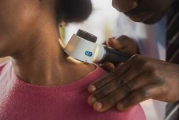 Why You Should Visit a Black Dermatologist Near Me in Marietta