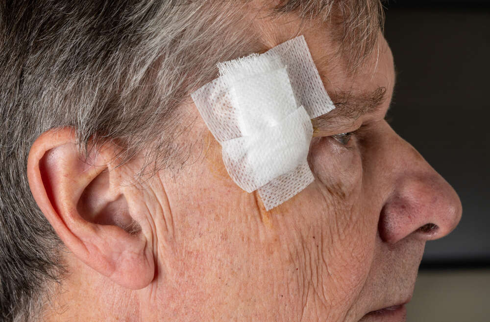 Does Mohs Surgery Leave a Scar?