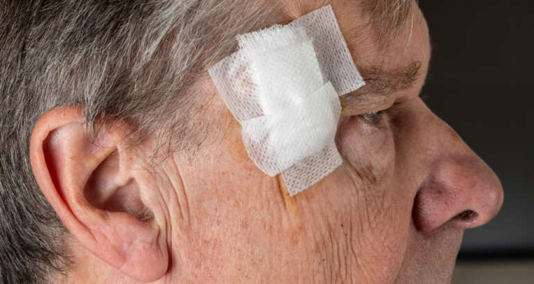 Does Mohs Surgery Leave a Scar?