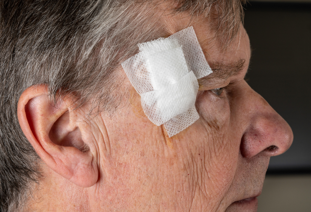 does Mohs surgery leave a scar?