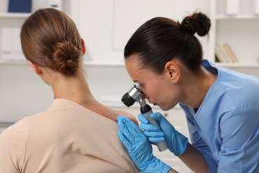 Why End of Summer Skin Checks Near Marietta, GA, Are So Important