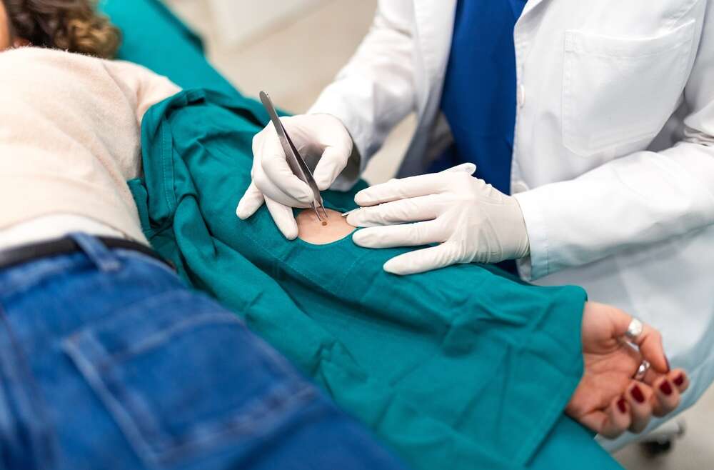 Skin Biopsies in Acworth: A Guide for Georgia Residents