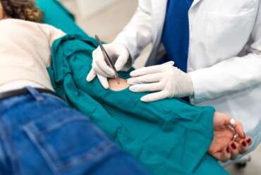 Skin Biopsies in Acworth: A Guide for Georgia Residents