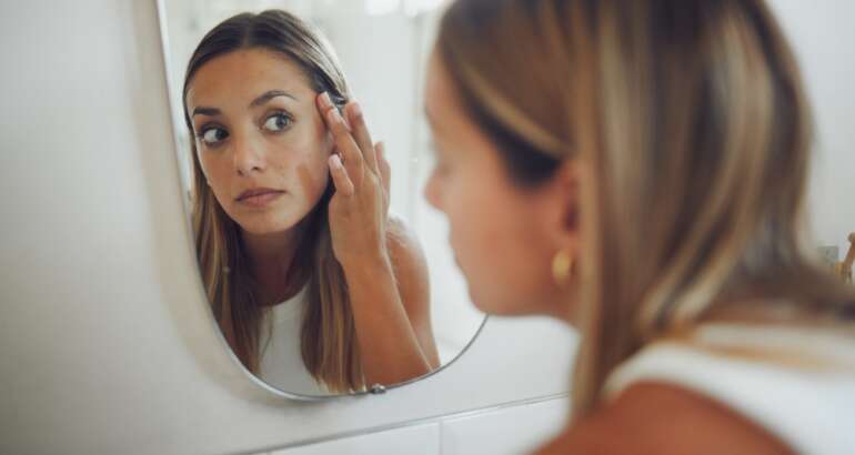 Hyperpigmentation Treatment Near Cartersville, GA: What Actually Fades Dark Spots